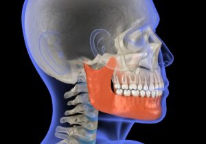 Jaw surgery in Chicago
